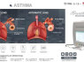 Differential pressure detection technology, with professional lung function software (3)