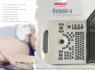Ultrasound Scanner adopts advanced high - precision digital beam former (2)