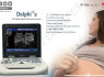 Ultrasound Scanner adopts advanced high - precision digital beam former (6)